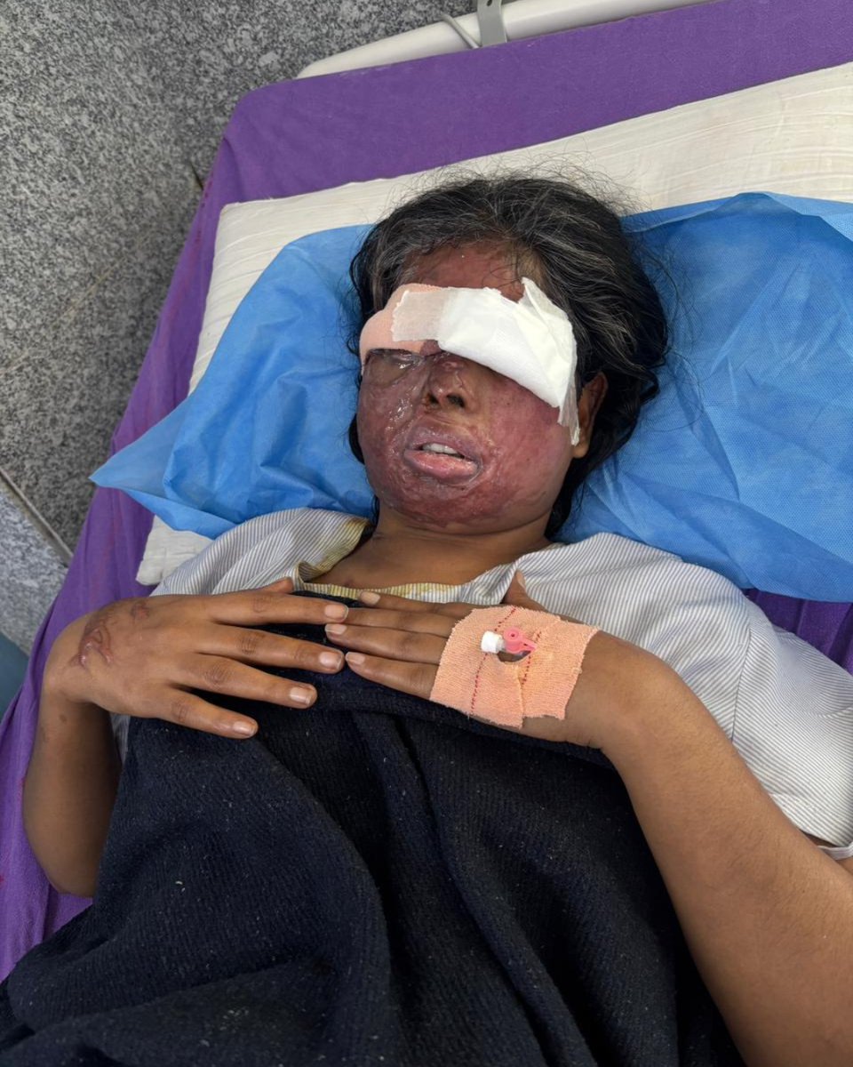 Stop Acid Attacks tweet media