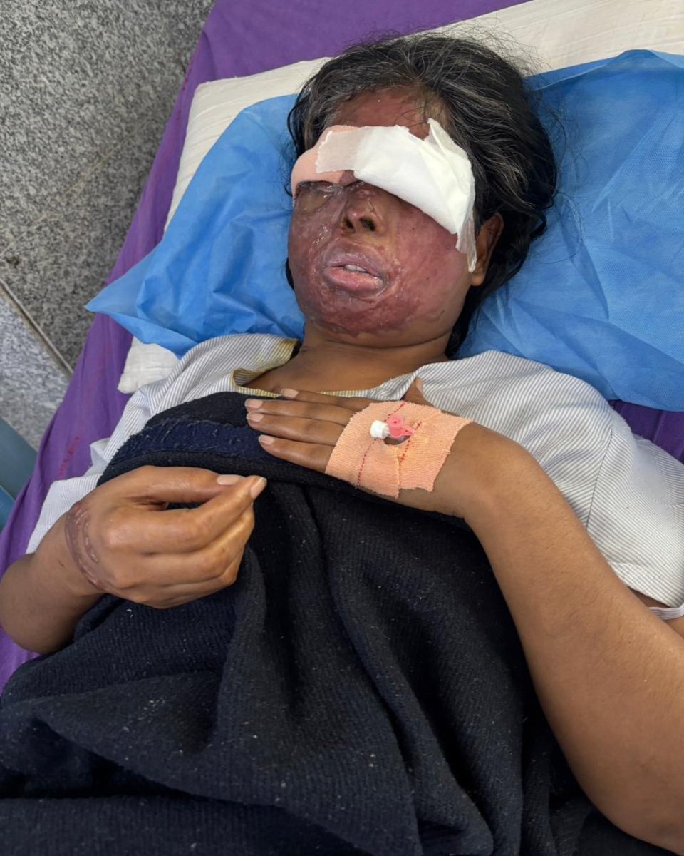 Stop Acid Attacks tweet media