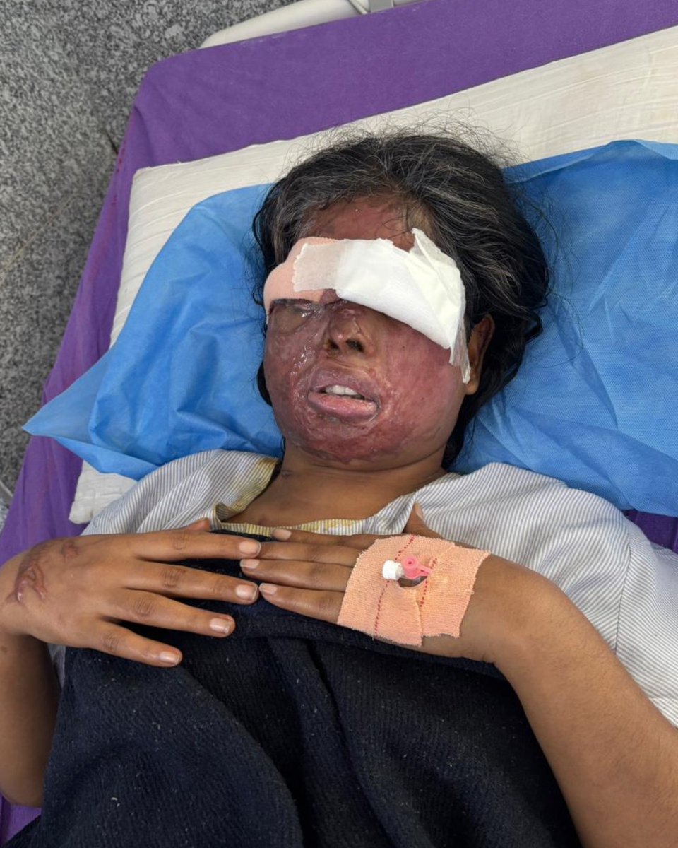 Stop Acid Attacks tweet media