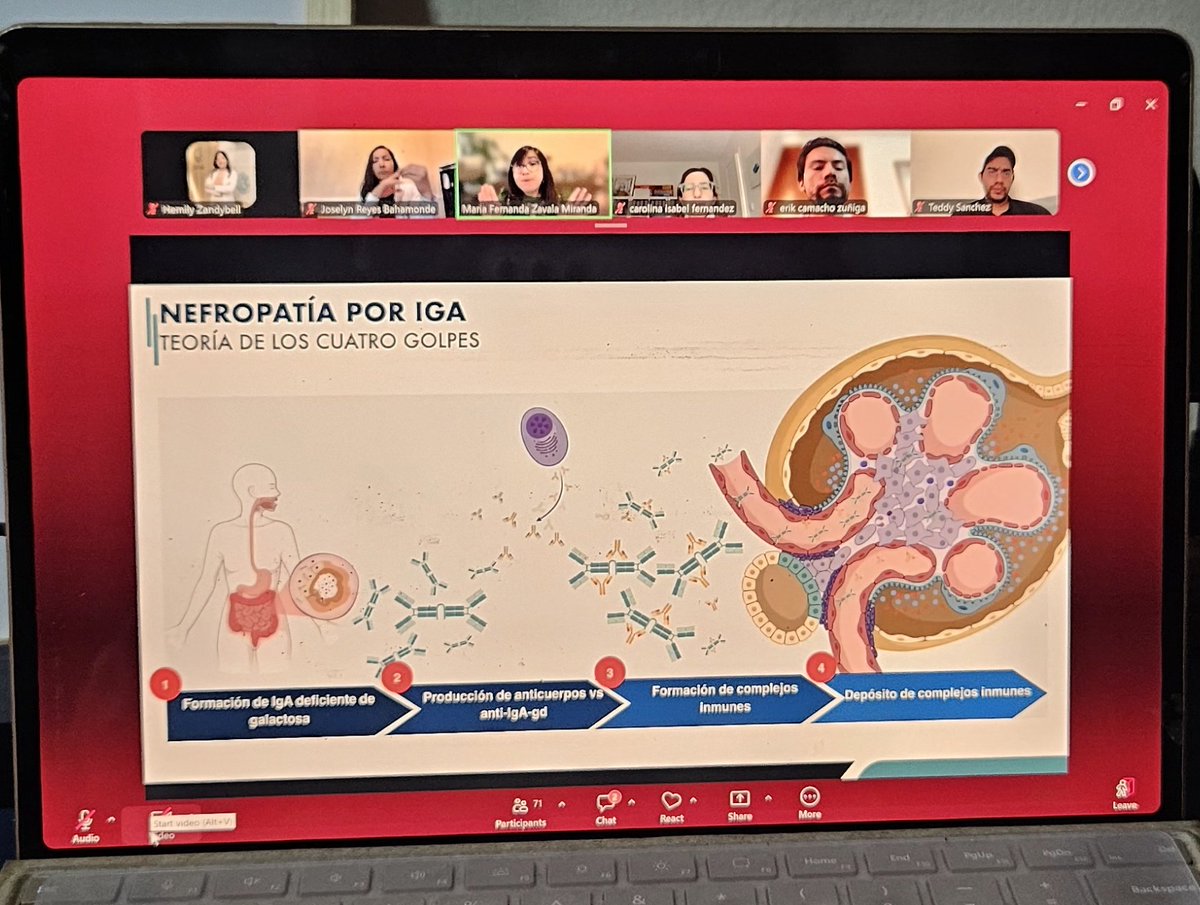 ZandybellNefro's tweet photo. Excelente charla a cargo de la dra @Mafer_ZavalaM , acerca de Nefropatia IgA. En los sábados de @GlomConILA 

🔸️Microhematuria = Daño endotelial, humo avisando que hay 🔥
🔸️Goal de Proteinuria: menor a 300 mg/24 horas 
🔸️Sparsentan + iSglt2 = Nuevo tratamiento de soporte https://t.co/dkvCfFh4v2