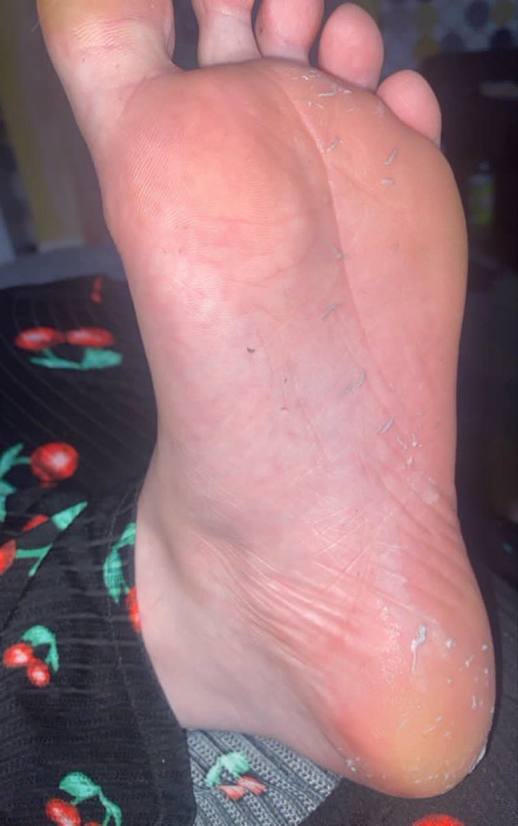 emptyforEmilia's tweet photo. I love doing a peel shot on my feet. 

findom paypig HumanATM Cashcow Finsub HumanWallet Sissy Beta slave Humiliation findomme walletdrain brat  #findom #femdom https://t.co/bEcYl5QeJB