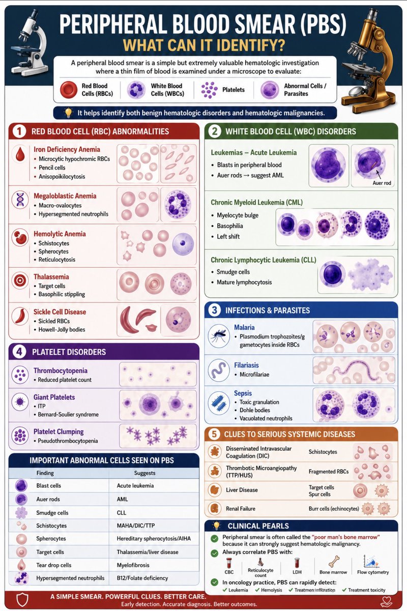 TheTutorMD's tweet photo. 🩸 The Peripheral Blood Smear (PBS): A liquid biopsy at your fingertips.✅

#MedTwitter #Hematology #MedEd #USMLE #Pathology #FOAMed #TutorMD

Name one distinct PBS finding and the clinical condition it points to. Let’s see how many unique ones we can get in the replies! 🩸 https://t.co/mqOuA3cvPj