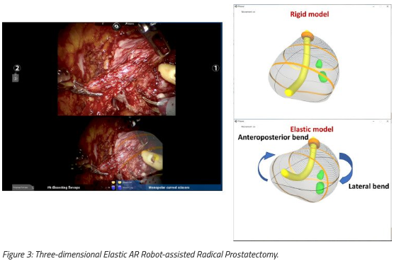 urotoday's tweet photo. State-of-the-Art Lecture: Advances in image-guided robotic surgery. Presentation @Cacciamani_MD @USC_Urology. #AUA26 written coverage by @helengao295 @UCI_Urology > https://t.co/wPjBZ4ocHg @AmerUrological #AUA2026 https://t.co/cTnLk1dCE1