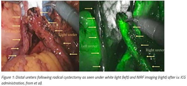 urotoday's tweet photo. State-of-the-Art Lecture: Advances in image-guided robotic surgery. Presentation @Cacciamani_MD @USC_Urology. #AUA26 written coverage by @helengao295 @UCI_Urology > https://t.co/wPjBZ4ocHg @AmerUrological #AUA2026 https://t.co/cTnLk1dCE1