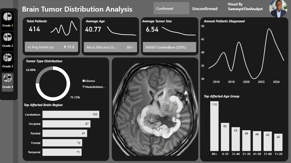 SammystDAnalyst's tweet photo. 🚀 My New Power BI Portfolio Project

Brain Tumor Distribution Analysis Dashboard 🧠📊

I recently completed a healthcare analytics project focused on analyzing brain tumor patient data using Power BI. https://t.co/Pn48Trpinj