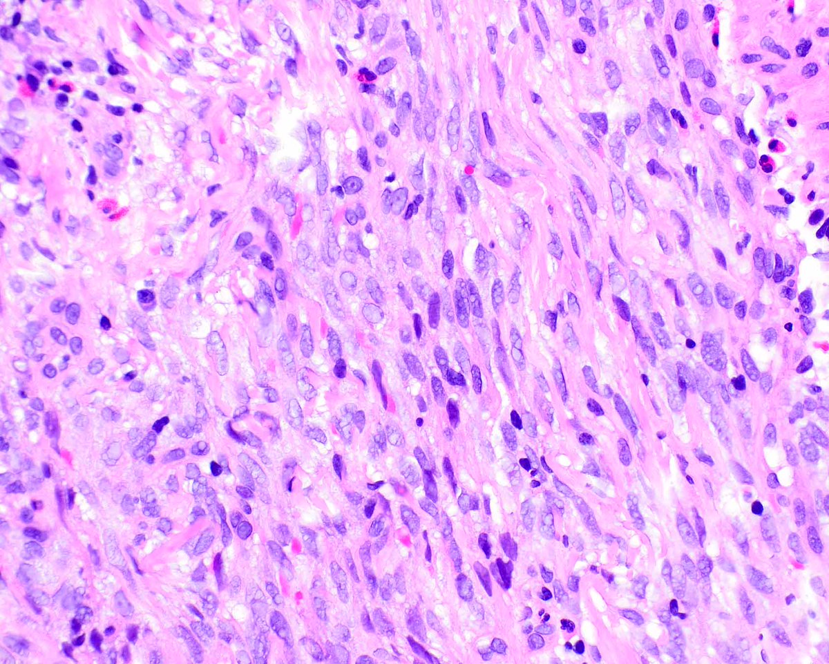 Modern Pathology tweet media