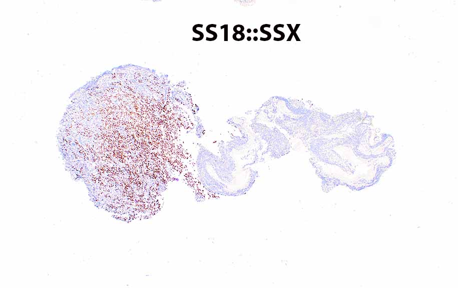 Modern Pathology tweet media
