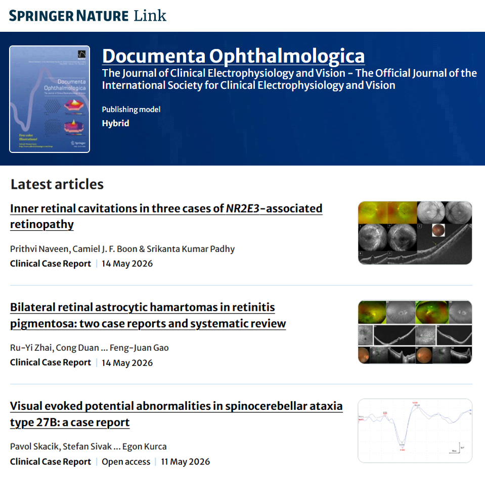 iscev_org's tweet photo. As you keep up with the literature, don’t forget to check out the latest articles featured on the @SpringerNature  Documenta Ophthalmologica website. https://t.co/KpNkAPXKK9