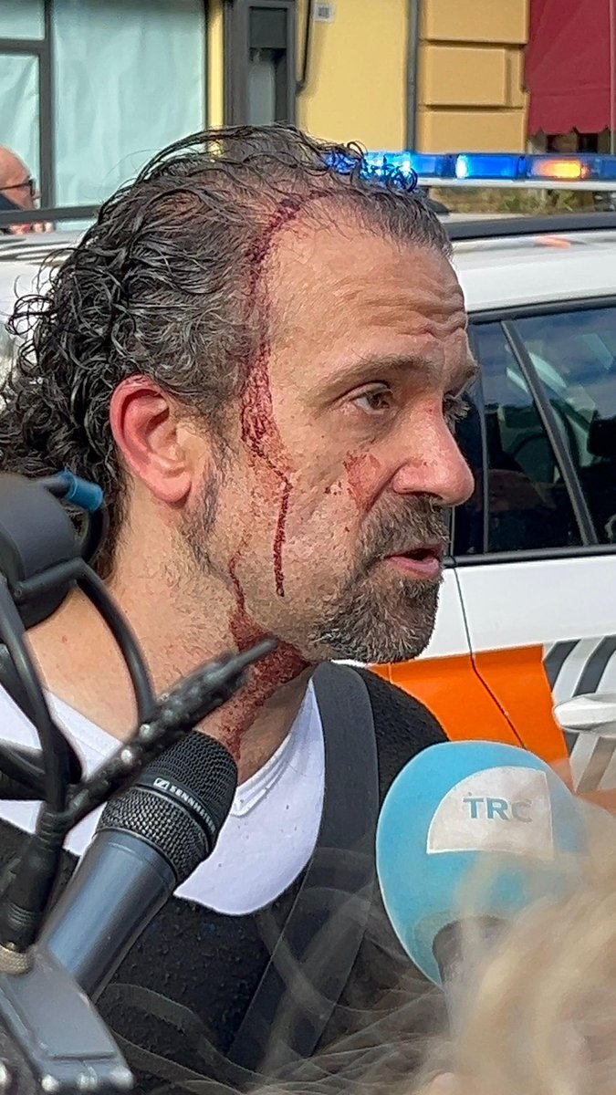 FratellidItalia's tweet photo. “Ho sentito il colpo arrivare al petto e subito dopo alla testa. In quel momento è scoppiato il caos. Sono riuscito a schivarne uno, ma l’altro mi ha preso. Nonostante questo, sono riuscito ad afferrargli il braccio e a fermarlo.”

È successo durante i momenti drammatici dell’attentato di Modena, quando un uomo ha travolto e falciato alcuni passanti seminando panico in strada. In mezzo alla paura generale, c’è stato anche chi ha scelto di intervenire.

Luca Signorelli è stato uno di quelli che non si sono tirati indietro. Pur ferito, ha continuato insieme ad altri presenti a cercare di bloccare l’aggressore, contribuendo a evitare conseguenze ancora più gravi.

La nostra solidarietà e vicinanza alla cittadinanza e tutti coloro che sono rimasti coinvolti in questa immane tragedia.