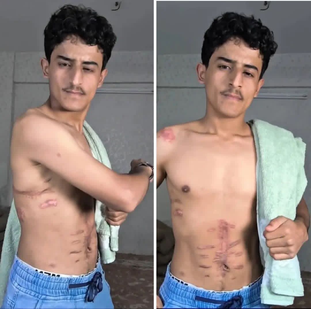 عبدالغني الزبيدي abdulghani alzubaidi tweet media