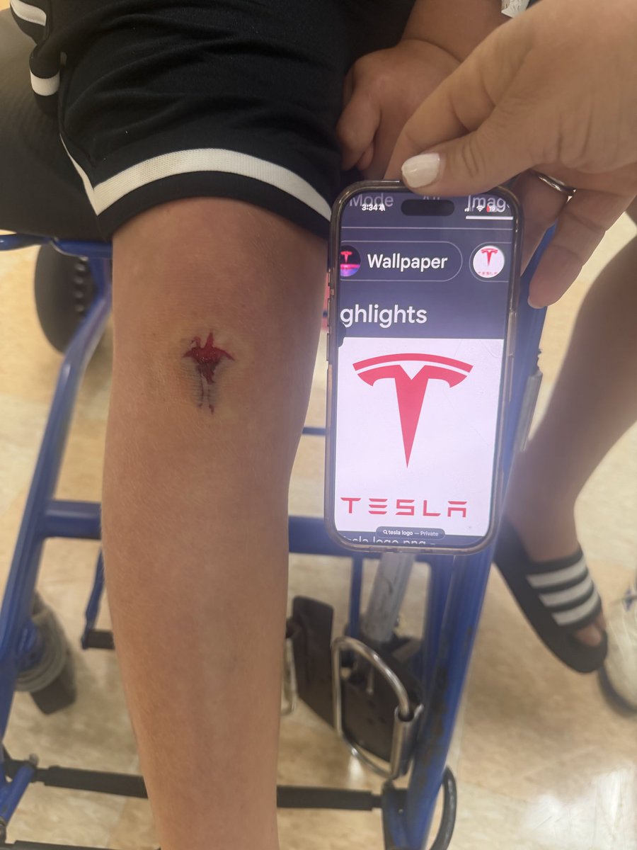 fedestrauch's tweet photo. @elonmusk my son loves Tesla so much his wound reflects this. https://t.co/o4m3bCribc