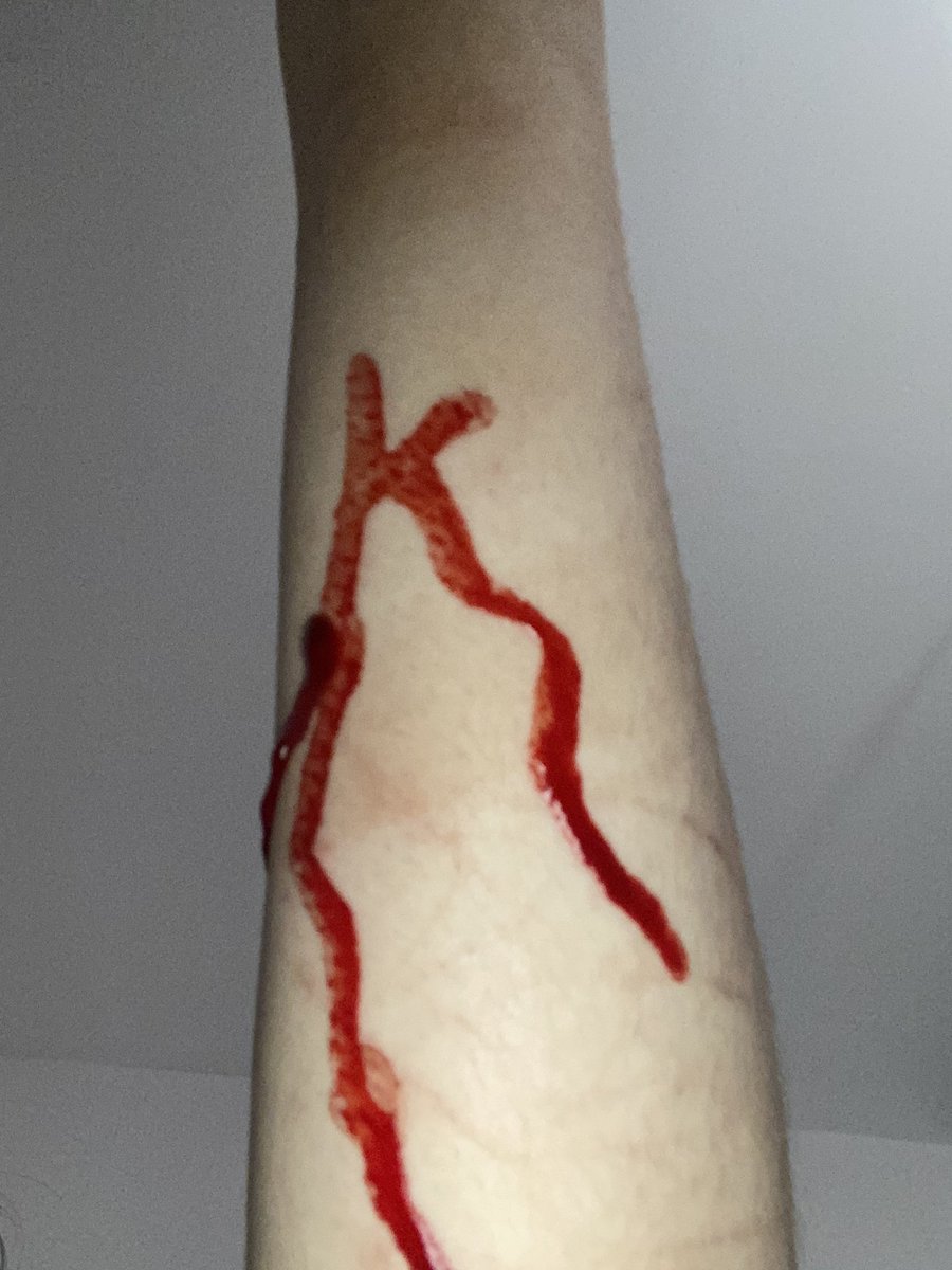 blade352337's tweet photo. it connected
then turned into a k
for kms 
#blood #shtwt https://t.co/8xeX9asOBt