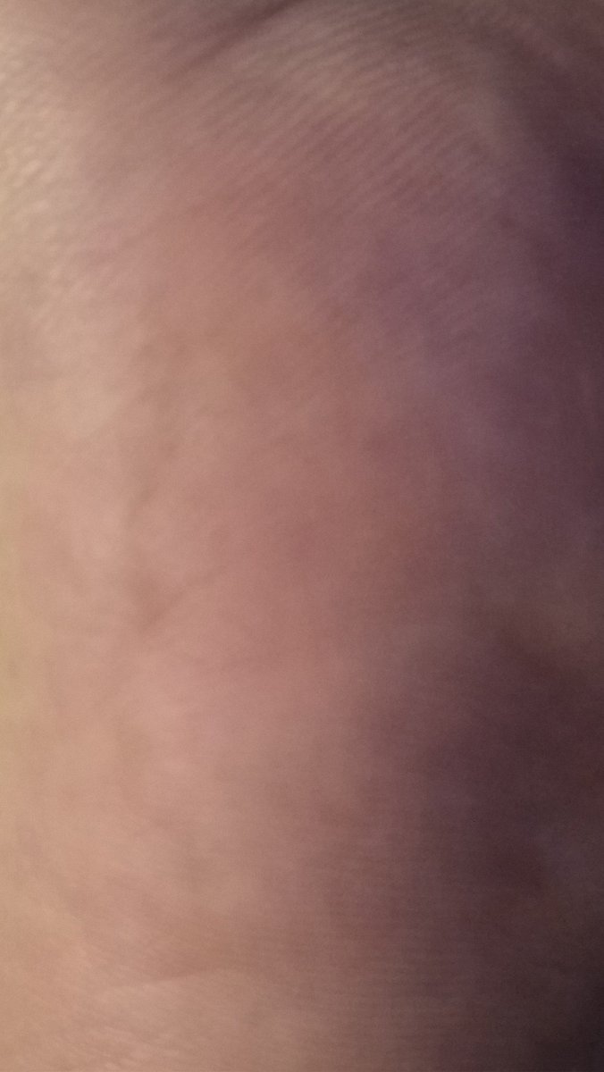 M0noM1nd's tweet photo. Moisturized and hydrated,  the move for 2026 #feetfetısh #feet #soles send a dm 😋 https://t.co/5j5KopEGsd
