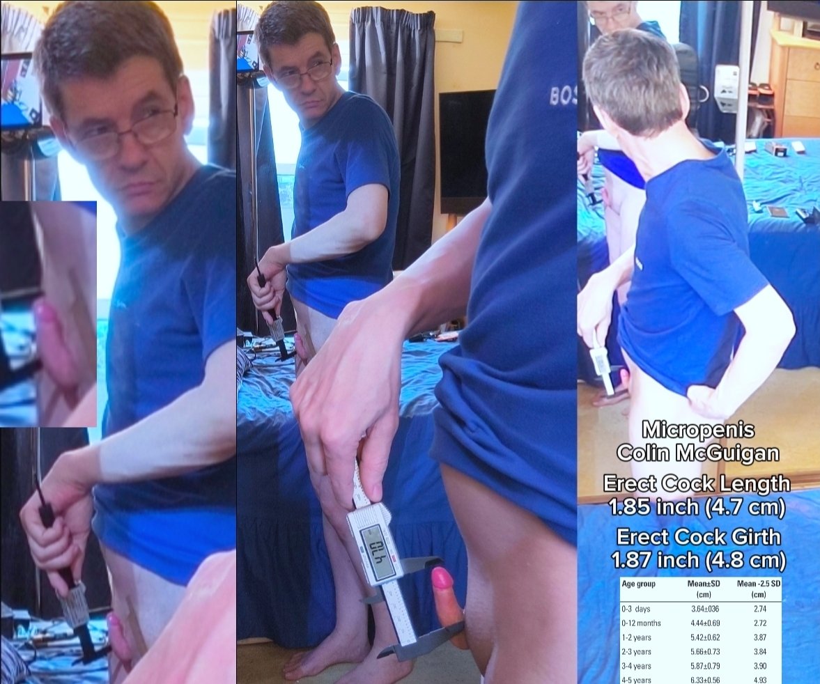 micropenis1_9's tweet photo. 1.85 inch erect length &amp; 1.87 inch erect girth. Extremely tiny &amp; extremely thin hard cock size even for a micropenis, plus a very petite girl body, girl legs &amp; no puberty https://t.co/W44VTShoQ4