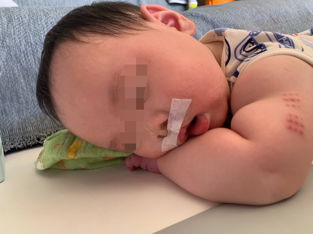 かなまる*👶🏻7m口唇口蓋裂 tweet media