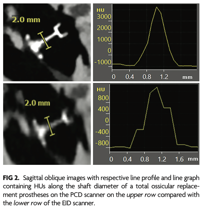 TheAJNR's tweet photo. "Comparative Analysis of Middle Ear Prostheses Using Photon-Counting Detector CT versus Conventional CT"

https://t.co/ZzbKkSpHnT

@iantmark https://t.co/bP7tt9Jti3