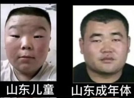 米线山🕶️ tweet media