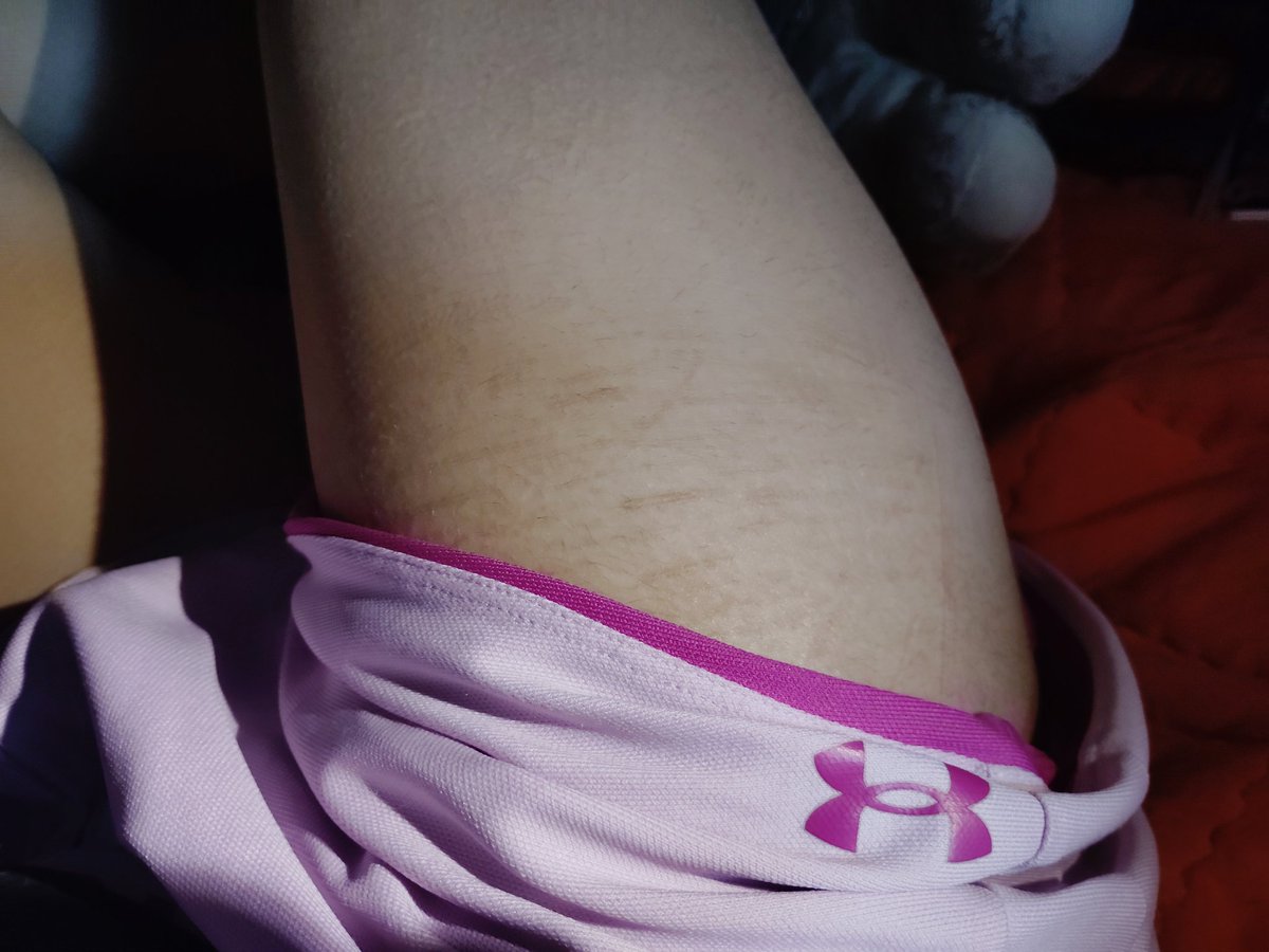 QuinnBanger's tweet photo. I'm tryna show off my scars but I'm low-key giving thinspo https://t.co/jb71zHVL0F