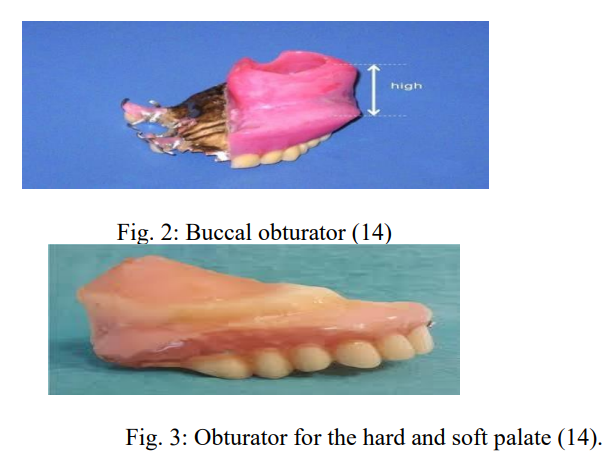 PacificJHealth's tweet photo. "The Influence of Prosthetic Obturators on Quality of Life in Individuals with Maxillectomy Defects"

- by Minseok Kim @UOPacific @dugoni_dental 

https://t.co/fgGJlnz4A2 #OpenAccess #OralHealth https://t.co/t1BU57Rwy2
