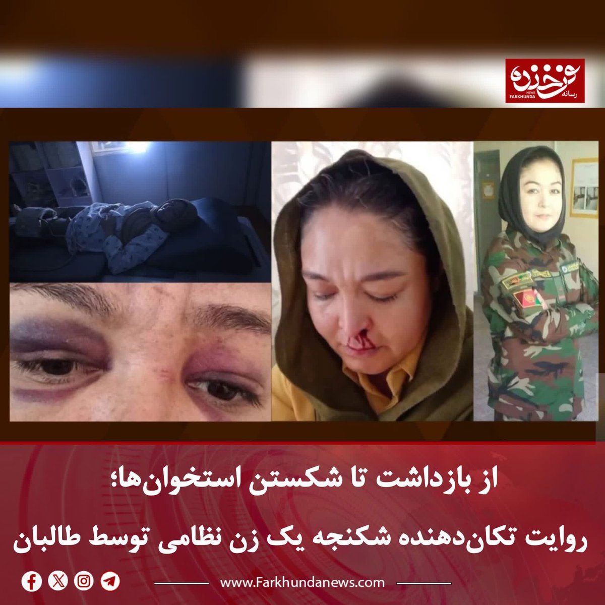 ShamailTawana's tweet photo. The Taliban have arrested a former female military officer and brutally tortured her in an unofficial prison, to the extent that the bones in her legs were broken. This is the true face of the Taliban. Yet there are still people who speak of negotiations and normalizing relations with them.

When a woman is subjected to such horrific torture because of her past, and the world continues to remain silent, it must be said that humanity has died here. No legitimacy can ever be built on the suffering, torture, and oppression of women.
#No_To_Taliban