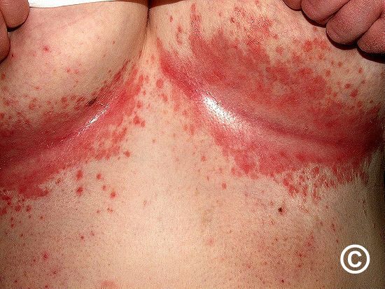 modernHealthMe's tweet photo. What's the Diagnosis? https://t.co/EQpYNwrM5K