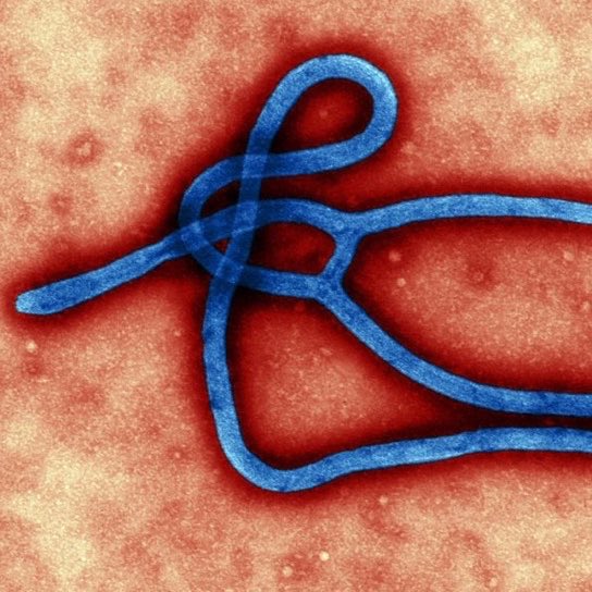 YourAnonOne's tweet photo. World Health Organization declares Ebola outbreak a global health emergency. https://t.co/D6RaA228gF