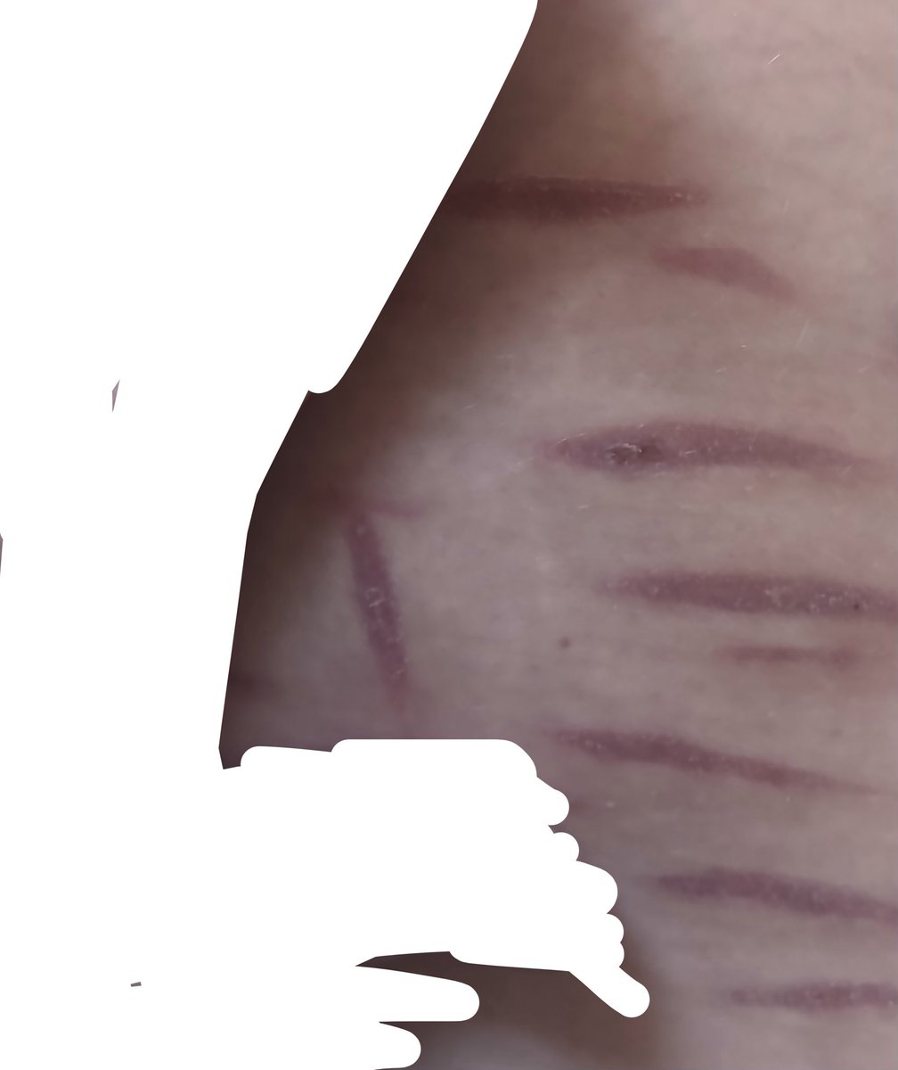 Syalt236's tweet photo. I crossed off my hand it was pissing me off, anyways this is how most of my cuts are coming along #shtwt #shedtwt #sfxmakeup https://t.co/CSDZPykPZV