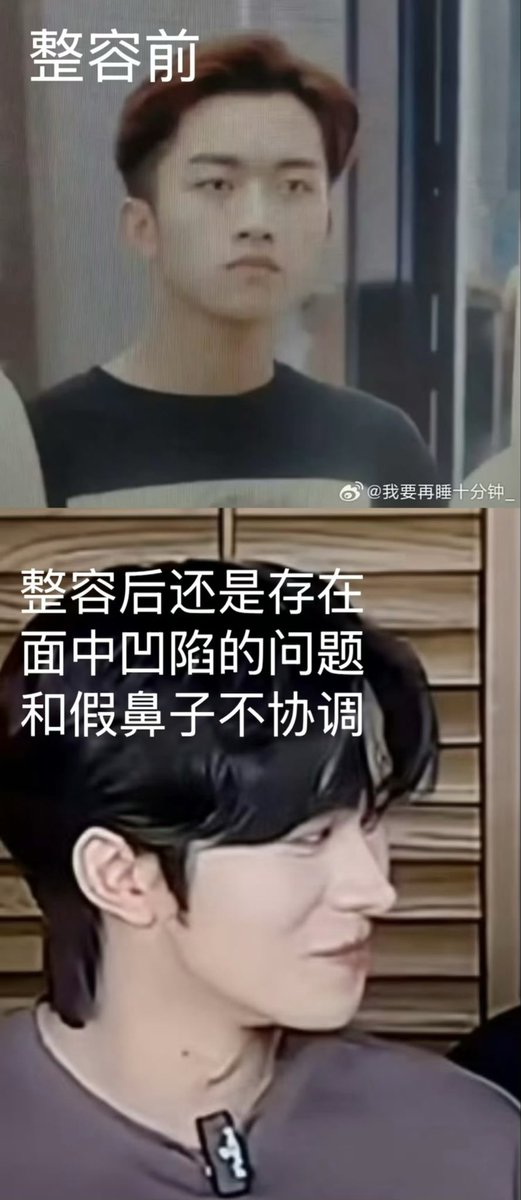 QQasvr's tweet photo. #Huangxing #EliotHuang 
Huang Xing before plastic surgeries: https://t.co/UeI2Hoq652