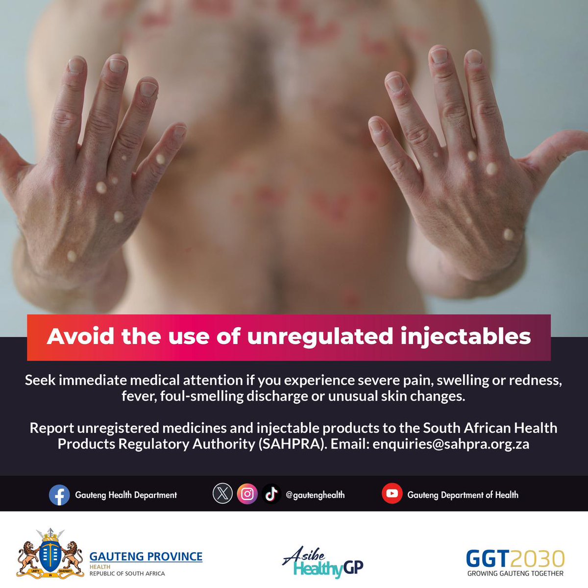 Symptoms Injection Pain, swelling, or a burning sensation after an injection is NOT a sign ...