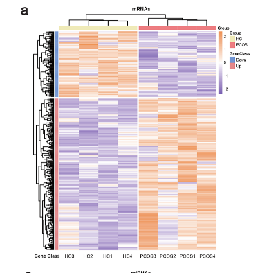 Phenomics_J's tweet photo. 🧬 New Research on #PCOS #Transcriptomics & #ceRNA Networks 🔄🩸✨
Integrated analysis of lncRNA, miRNA, and mRNA in peripheral blood uncovers key regulatory modules for polycystic ovary syndrome! 🎯🧪
Key Insights:
 ✅ Whole transcriptome sequencing of 4 PCOS case-control pairs – 341 mRNAs, 252 lncRNAs & 47 miRNAs differentially expressed 📊
 ✅ DEGs enriched in metabolism, immune response, endocrine, and even nervous system pathways 🧠🛡️
 ✅ #WGCNA identified a turquoise module strongly correlated with PCOS and inversely associated with age 📉
 ✅ Core regulatory axes: #miR-17-5p → LINC02213/FCGR1A and RP11-405F3.4 → IL1R1/IL27 🔗
 ✅ #LINC02649 emerged as a hub lncRNA with multiple miRNA/mRNA partners – high potential as a biomarker 🎯
📚Published by: Rui Lin, Saihua Zheng, Haiyu Su, Guiying Wang, Xuelian Li, Chenqi Lu
 📅 Published in: 2024
 📄 Full Study: https://t.co/e7WcNROeyX
#lncRNA #miRNA #WGNA #ReproductiveHealth #Endocrinology #Biomarkers #SystemsBiology #NGS 🚀