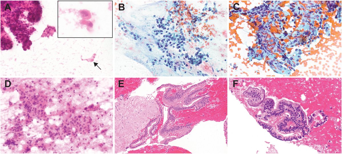 Cancer Cytopathology tweet media