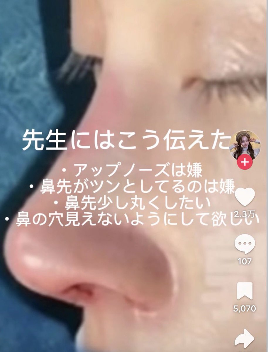 鼻整形の良医選び🏥鼻尖形成、鼻中隔延長、鼻フル、プロテーゼ、鼻翼縮小、小鼻縮小、貴族手術、人中短縮 tweet media