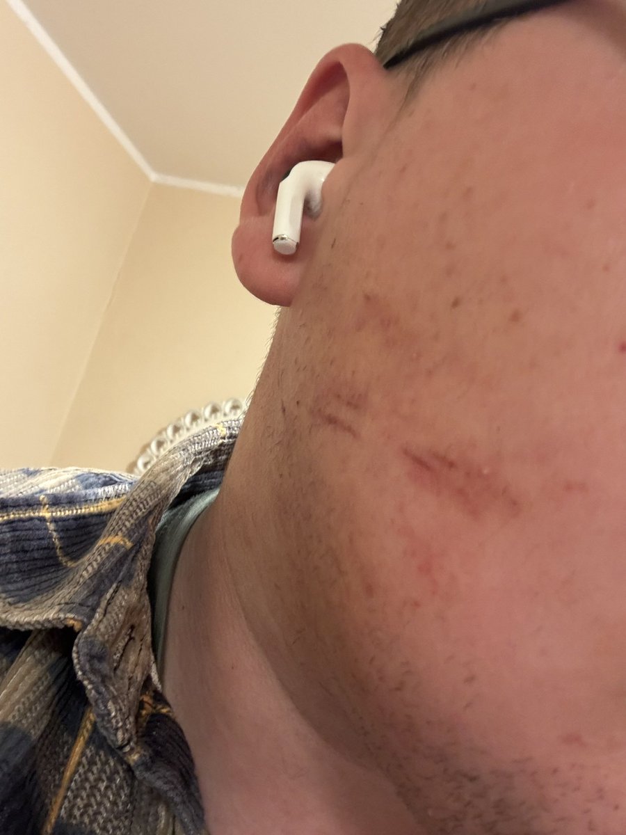 subslave3333's tweet photo. This is what I got for being a f*ggot from @italiancashdom and his bros, I won’t even mention what happened to my balls 😭 check out their newest video to see more. https://t.co/0siW22151w
