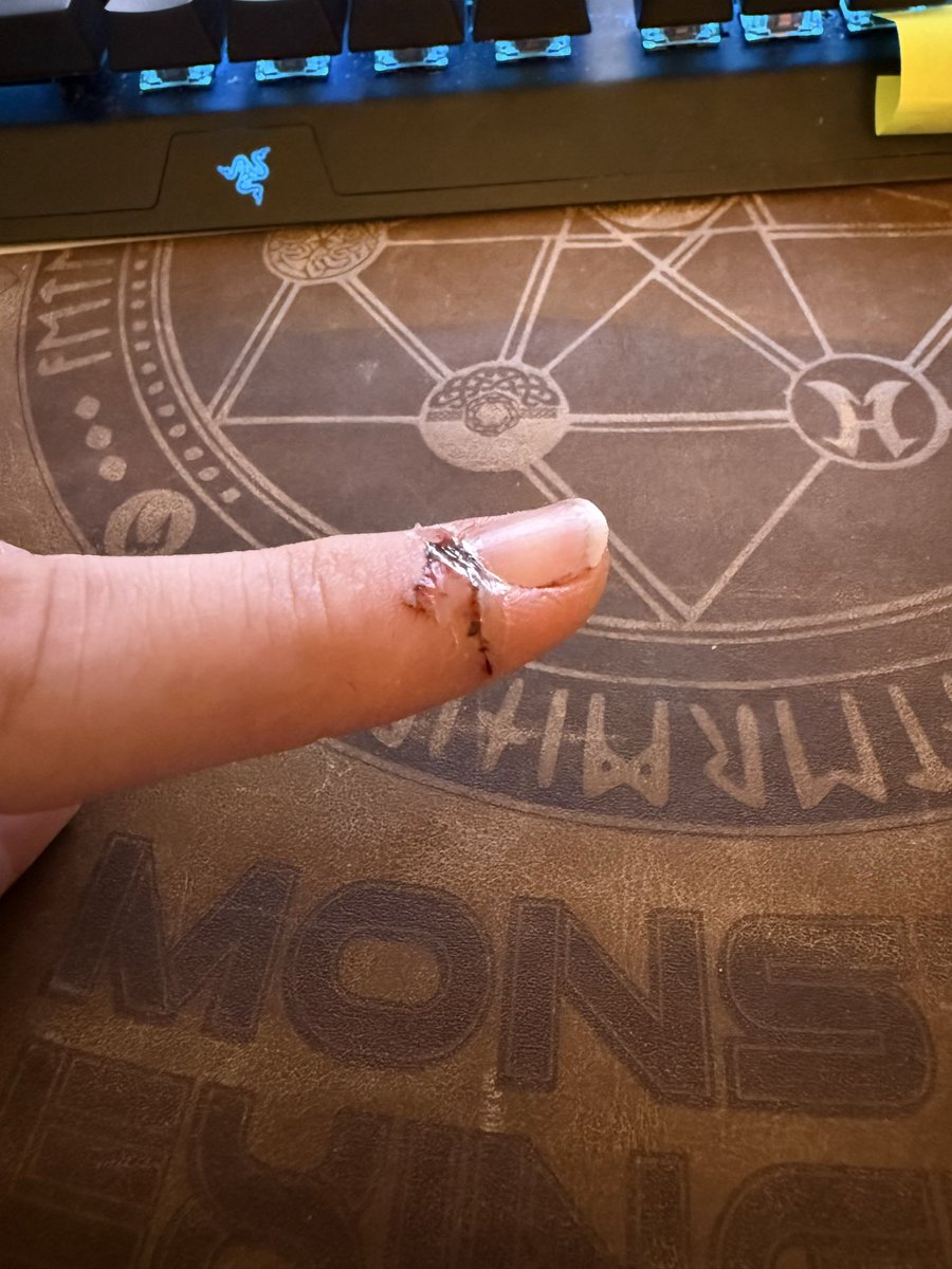 Ohdatpro's tweet photo. @wizards_magic I cut my finger and could really use a Shaman’s help. RELEASE THE SHAMAN https://t.co/buGmvr0His