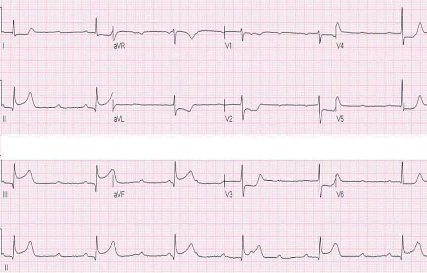ECGWeekly tweet media