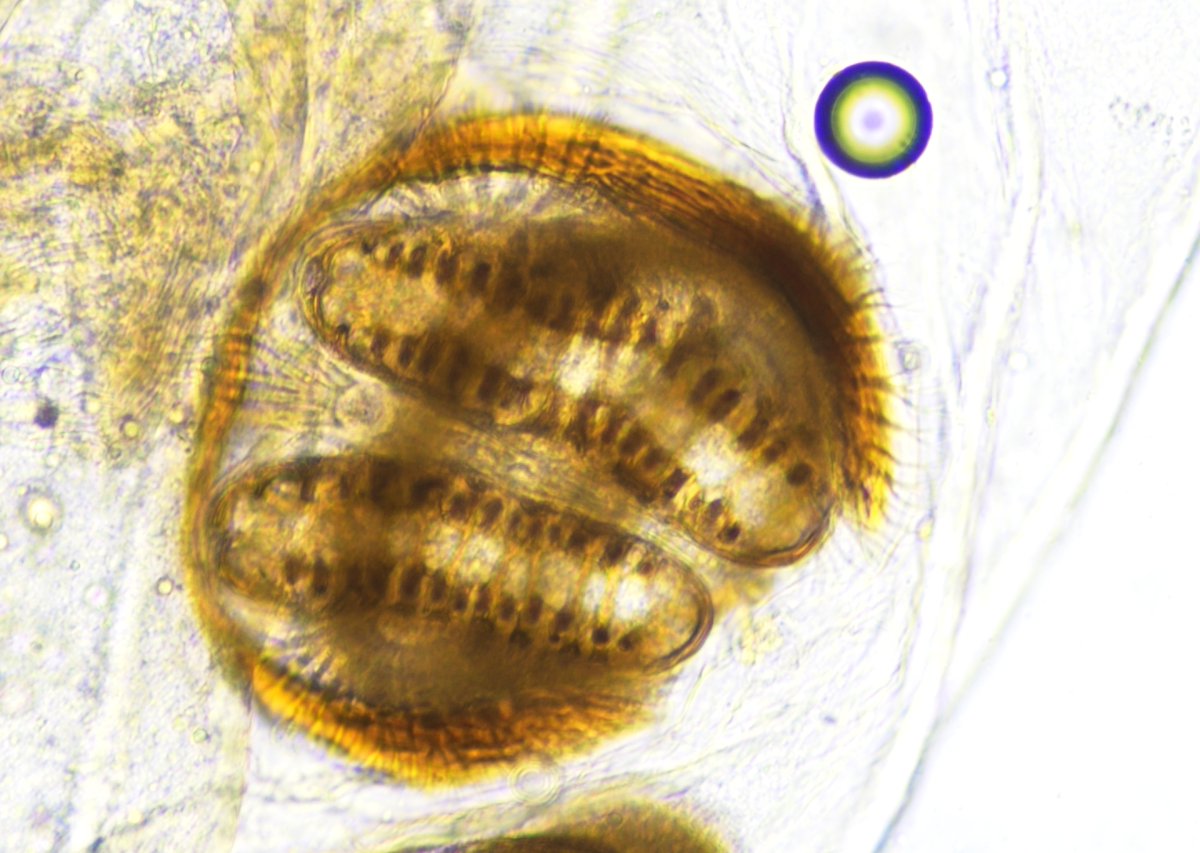 ParasiteGal's tweet photo. The #Parasite Case 809 is up: Fly larva submitted with no clinical history 😒😢. How would you sign this case out? What additional information would you like?
Answer later this week! #mayopath #pathology #PathBugs #CrittersOnTwitter https://t.co/5JfgdUimB0