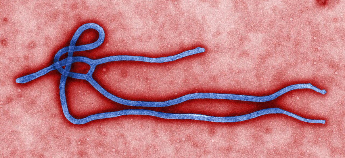 hoc111's tweet photo. Um dos vírus mais mortais do planeta está de volta. O Ebola reapareceu na República Democrática do Congo e já chegou a Uganda

A OMS declarou emergência internacional neste domingo. 246 casos suspeitos. 80 mortes. E o surto real pode ser maior do que o que está sendo detectado

O pior: essa cepa do Ebola não tem vacina nem tratamento aprovado
