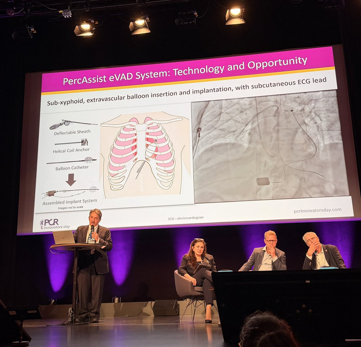 AndreaScotti21's tweet photo. 🏆 Jon DeHaan Foundation Award — #PCRID 2026

🔹 TriFlo — TR Tx (Sarkar)

🔹 eVAD System — extravascular LV/RV assist device (Krucoff)

🔹 CARLEN System — first-in-human for functional MR (Kodali)

Three innovations. One prize. Which would you back?

#EuroPCR #treatTR #Innovation https://t.co/UnShdnJjzj