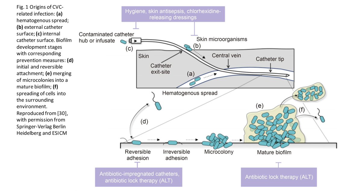 BioDesignManuf's tweet photo. Strategies for combating central venous catheter-related bacterial infections

Learn more: https://t.co/ifvNJZ5rgp https://t.co/3hmokQWJfw