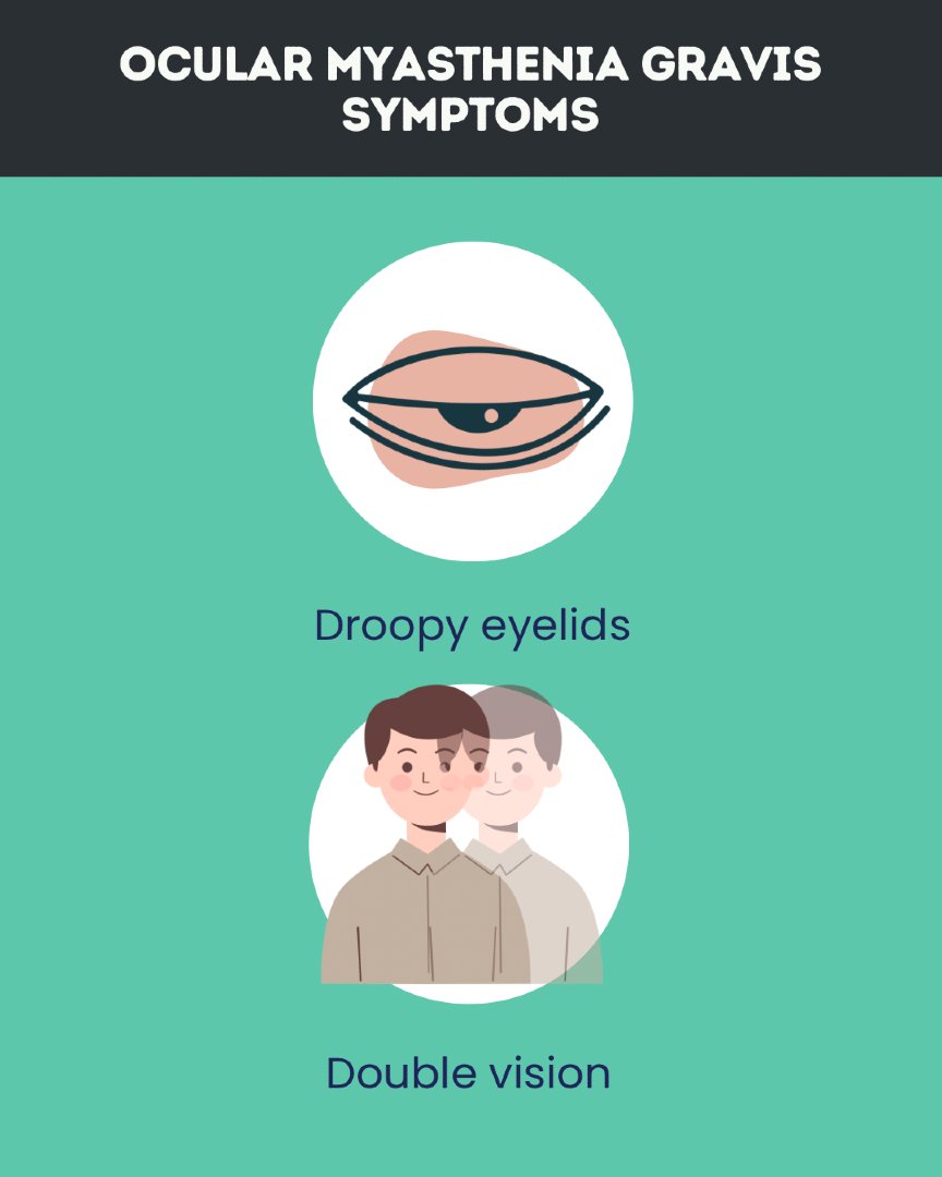 MyastheniaGNews's tweet photo. Know Eye MG Signs: https://t.co/rvLKNJpKga

#OcularMG #MyastheniaGravis #VisionProblems #MyastheniaGravisNews #Bionews https://t.co/CnTdFvPHrO