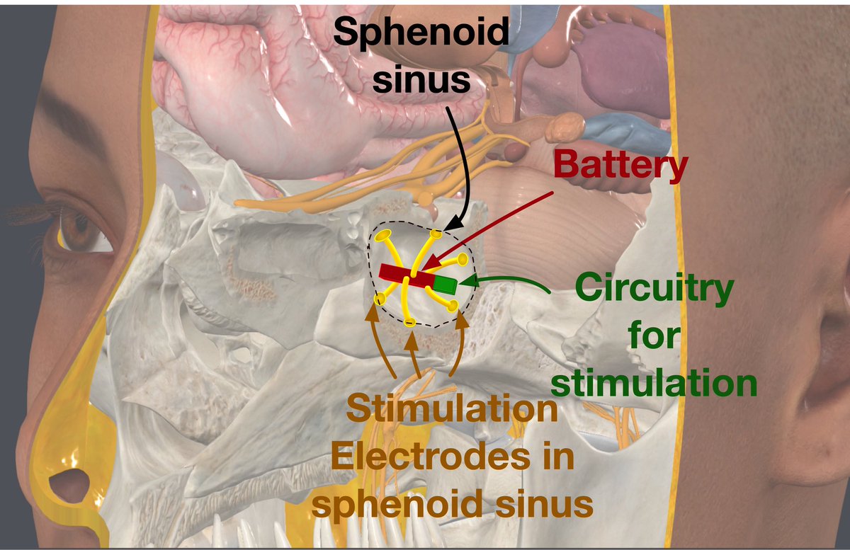 CMU_ECE's tweet photo. Researchers introduce transnasal electrical stimulation, a technique that places electrodes at the base of the skull via the nasal cavity that could transform deep brain stimulation.
https://t.co/tJ7ORAgblo https://t.co/meuYR9p46C