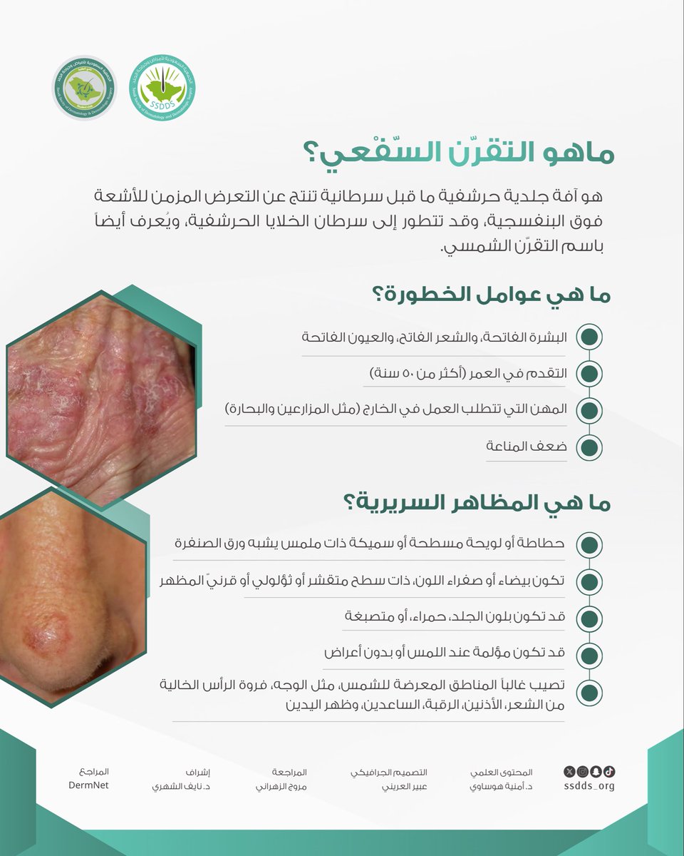Saudi Society of Dermatology & Derm Surgery(SSDDS) tweet media