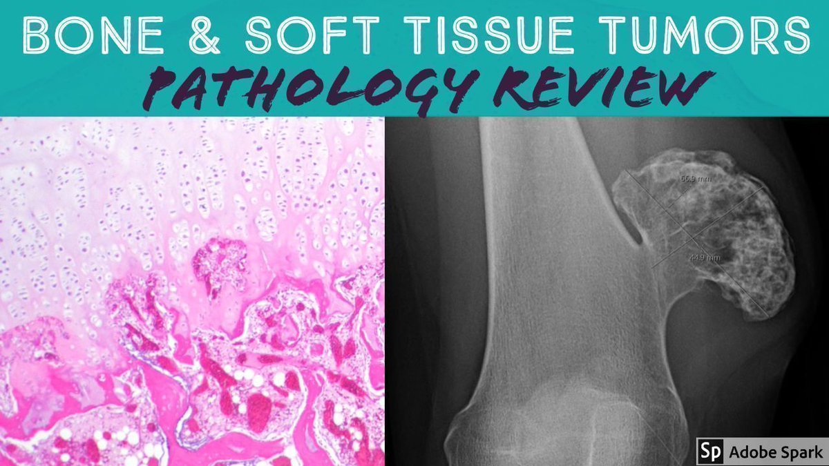 JMGardnerMD's tweet photo. Check out my Bone & Soft Tissue #Pathology review video: https://t.co/LYjPpKH3b4. Review of 21 classic #BSTpath WSI digital slides via @ PathPresenter: https://t.co/u2KPqs8vDE. @ mydermpath Some #radiology, too! #radpathmatch #pathologists #orthotwitter https://t.co/FAGQEdZ07P