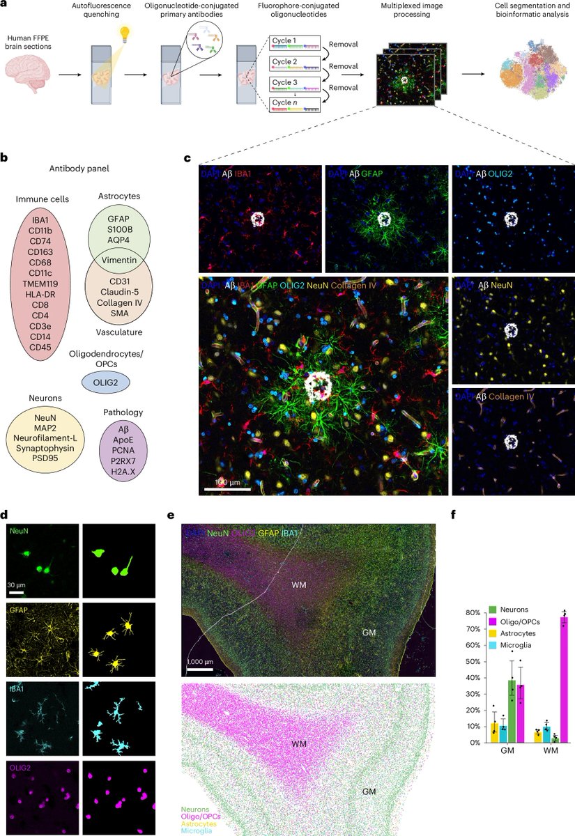rust_ruslan's tweet photo. Cool study! 

Spatial proteomic analysis in human Alzheimer’s disease brains enables identification of microenvironment-dependent microglial cell states @NatureNeuro 

https://t.co/1dGUwBXFz8 https://t.co/yesA4UPDEh