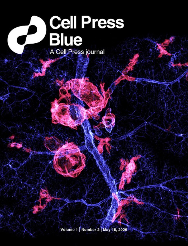 AshleyKiemen's tweet photo. The new Issue of @cellpressblue is out today with CODA on the cover! Here you see normal pancreatic ducts in blue with tens of precancerous lesions throughout in red. Read more in our recent article here: https://t.co/g23rDAavvY https://t.co/S0eMpAMyXM