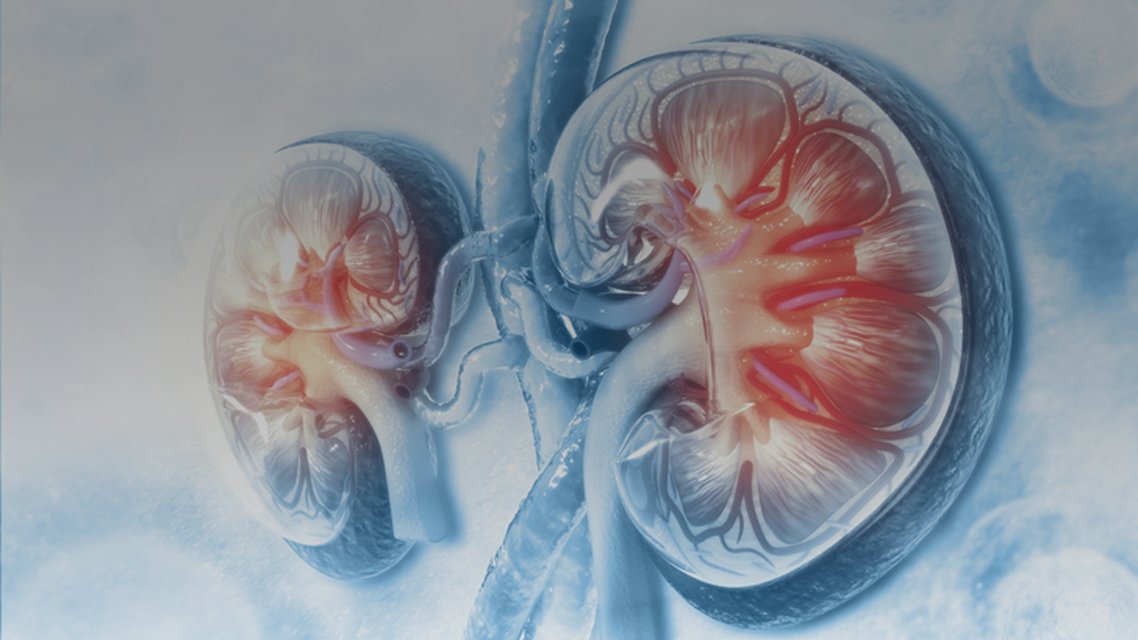 GKA_CME's tweet photo. What role does the complement pathway play in ANCA-associated vasculitis? Explore how C5a-mediated neutrophil activation contributes to inflammation, vascular injury, and kidney damage in AAV: https://t.co/O3Awxi7vZg #AAV #Nephrology https://t.co/nJa8scCTkx
