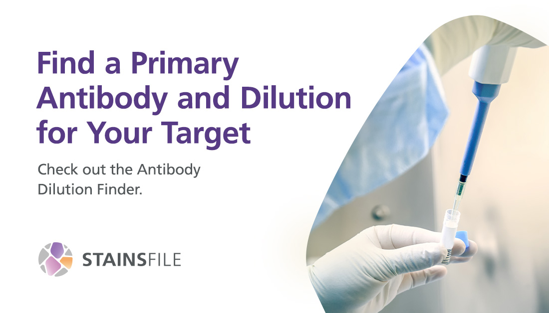 StainsFile's tweet photo. Tired of trial-and-error with your antibodies? Finding the right conditions shouldn’t slow you down.

🧫 Get tailored dilutions for your targets in seconds with our Antibody Dilution Finder: https://t.co/F5TGRSr7at https://t.co/ELQP8MenB2