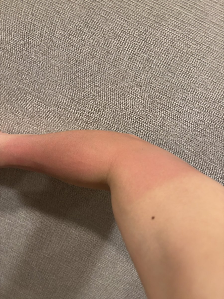 中山優馬 tweet media