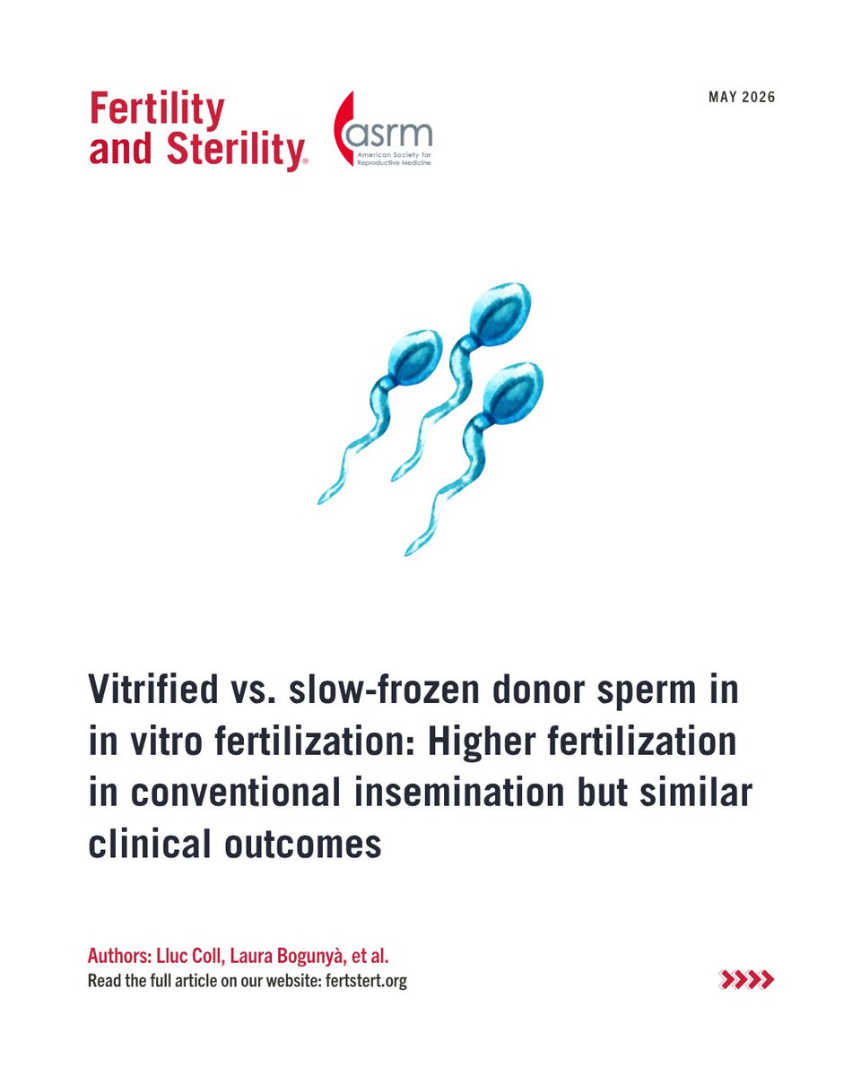 FertStert's tweet photo. Vitrified vs. slow-frozen donor sperm in in vitro fertilization: Higher fertilization in conventional insemination but similar clinical outcomes

Full text 👇
https://t.co/rOf5tsNCMO https://t.co/bjTU2Cdvhu