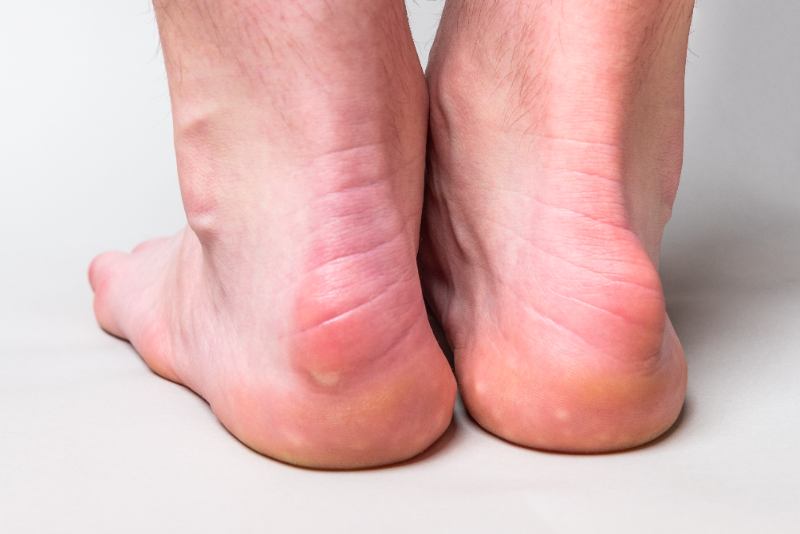 Austin Foot and Ankle Specialists tweet media